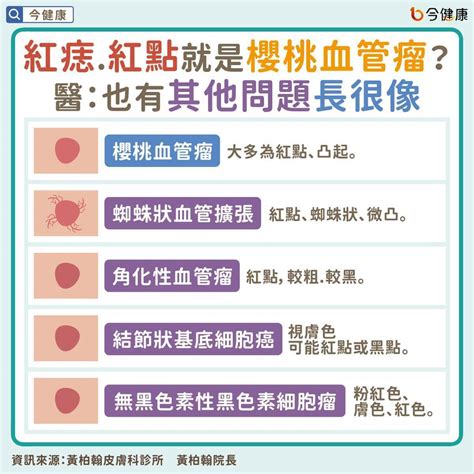 胸部長很多痣|皮膚長「紅痣」會怎樣？跟黑痣有何不同？會是皮膚癌。